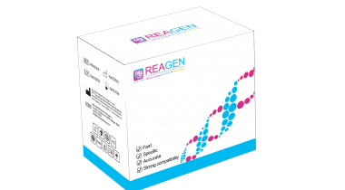 HemaFus WT1基因mRNA 表達量定量檢測試劑盒 （PCR-熒光探針法）